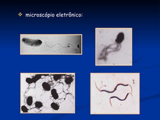 microscópio eletrônico: 