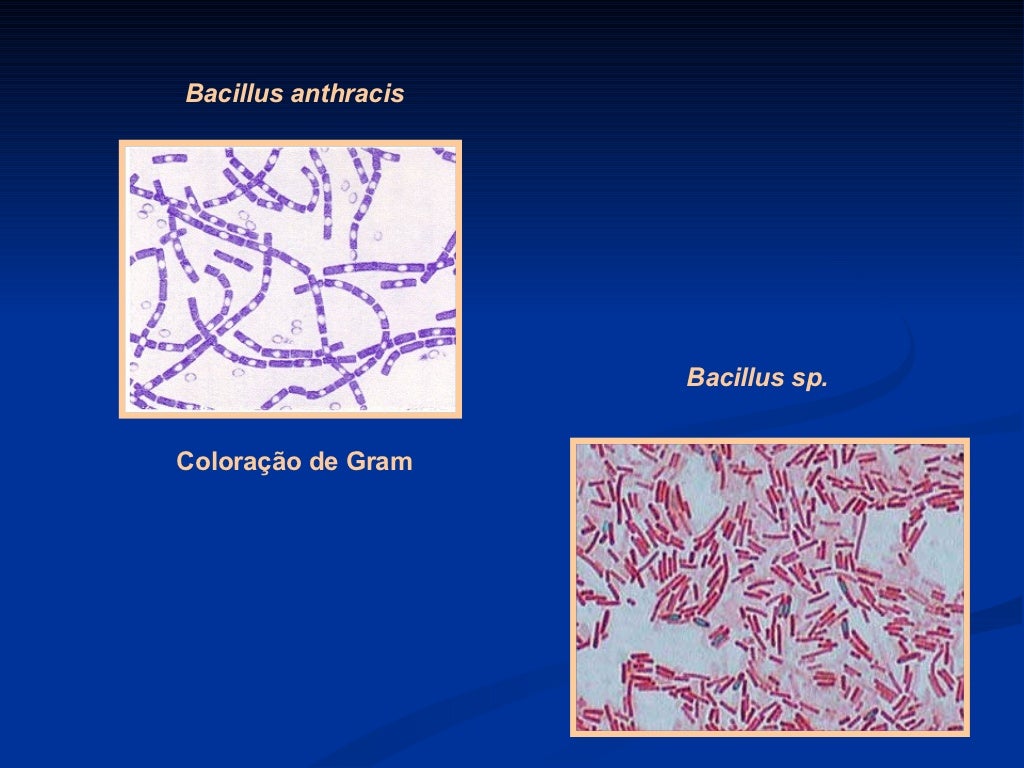 Sobre A Citologia Bacteriana é Correto Afirmar Que