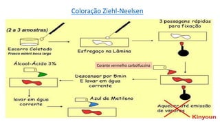 Corante vermelho carbolfucsina
Coloração Ziehl-Neelsen
 