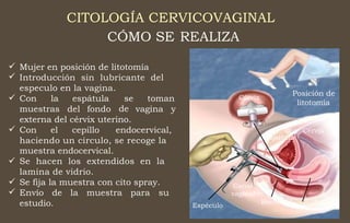 CITOLOGÍA CERVICOVAGINAL
CÓMO SE REALIZA


Mujer en posición de litotomía
Introducción sin lubricante del
especulo en la vagina.
Posición de
litotomía
 Cérvix
Con la espátula se
de
toman
muestras del fondo vagina y
externa del cérvix uterino.
 Con el cepillo endocervical, Cérvix
Espátula
haciendo un circulo, se recoge la
muestra endocervical.
Se hacen los extendidos en la
lamina de vidrio.
Se fija la muestra con cito spray.
Envío de la muestra para su
estudio.



Canal
vaginal
Recto
Espéculo Útero
 