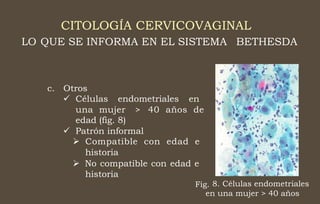 CITOLOGÍA CERVICOVAGINAL
LO QUE SE INFORMA EN EL SISTEMA BETHESDA
c. Otros
 Células endometriales en
una mujer
edad (fig. 8)
> 40 años de
 Patrón informal
 Compatible con edad e
historia
 No compatible con edad e
historia
Fig. 8. Células endometriales
en una mujer > 40 años
 