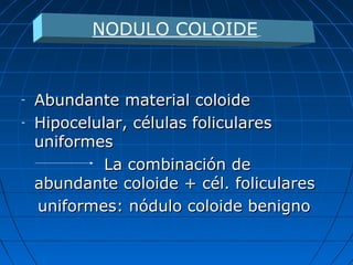 - Abundante material coloideAbundante material coloide
- Hipocelular, células folicularesHipocelular, células foliculares
uniformesuniformes
La combinación deLa combinación de
abundante coloide + cél. folicularesabundante coloide + cél. foliculares
uniformes: nódulo coloide benignouniformes: nódulo coloide benigno
NODULO COLOIDE
 