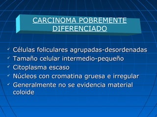  Células foliculares agrupadas-desordenadasCélulas foliculares agrupadas-desordenadas
 Tamaño celular intermedio-pequeñoTamaño celular intermedio-pequeño
 Citoplasma escasoCitoplasma escaso
 Núcleos con cromatina gruesa e irregularNúcleos con cromatina gruesa e irregular
 Generalmente no se evidencia materialGeneralmente no se evidencia material
coloidecoloide
CARCINOMA POBREMENTE
DIFERENCIADO
 