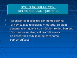  Abundantes histiocitos con hemosiderinaAbundantes histiocitos con hemosiderina
 Si hay células foliculares y material coloide:Si hay células foliculares y material coloide:
degeneración quística de nódulo tiroideo benignodegeneración quística de nódulo tiroideo benigno
 Si no se encuentran células foliculares:Si no se encuentran células foliculares:
no descartar posibilidad de carcinomano descartar posibilidad de carcinoma
papilar quísticopapilar quístico
BOCIO NODULAR CON
DEGENERACION QUISTICA
 