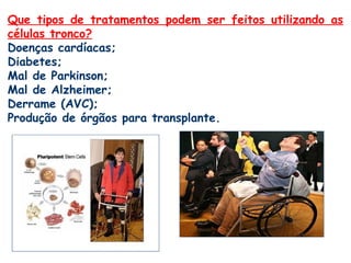 Que tipos de tratamentos podem ser feitos utilizando as
células tronco?
Doenças cardíacas;
Diabetes;
Mal de Parkinson;
Mal de Alzheimer;
Derrame (AVC);
Produção de órgãos para transplante.
 