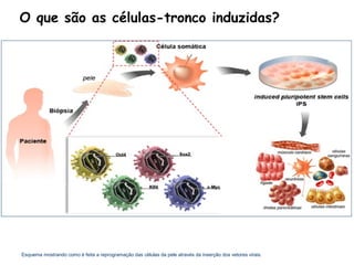 O que são as células-tronco induzidas?




Esquema mostrando como é feita a reprogramação das células da pele através da inserção dos vetores virais.
 
