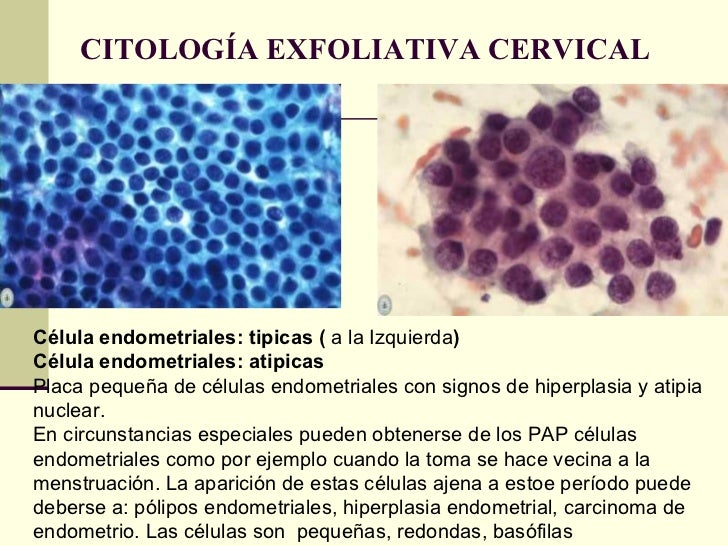 Celulas Endometriales En Mujeres Mayores De 40 Años Consejos Celulares Celulas Endometriales En Mujeres Mayores De 40 Años Consejos Celulares