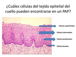 ¿Cuáles células del tejido epitelial del cuello pueden encontrarse en un PAP?Células superficialesCélulas intermediasCélulas parabasalesCélulas basales