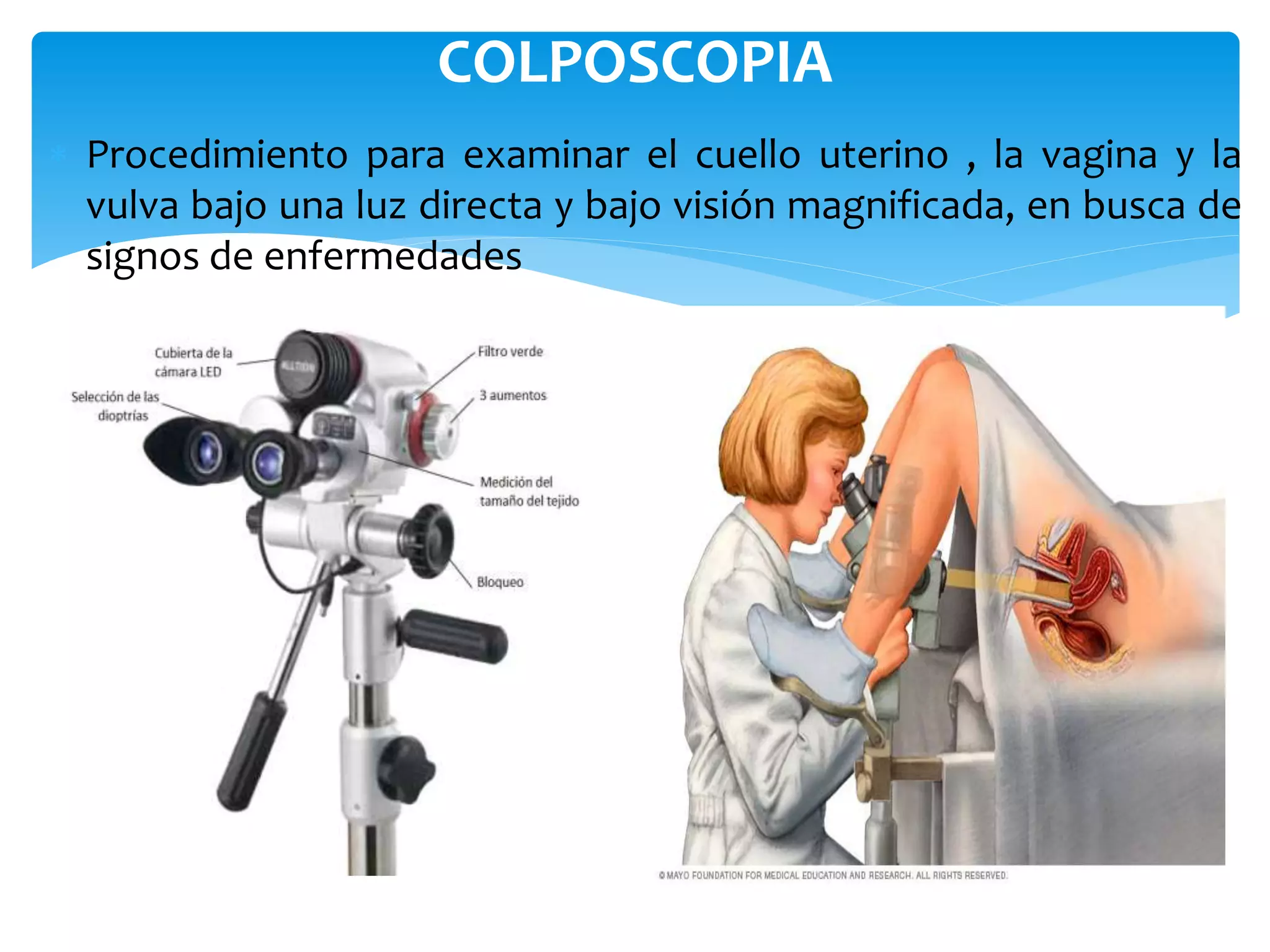 citologia y colposcopia.pptx