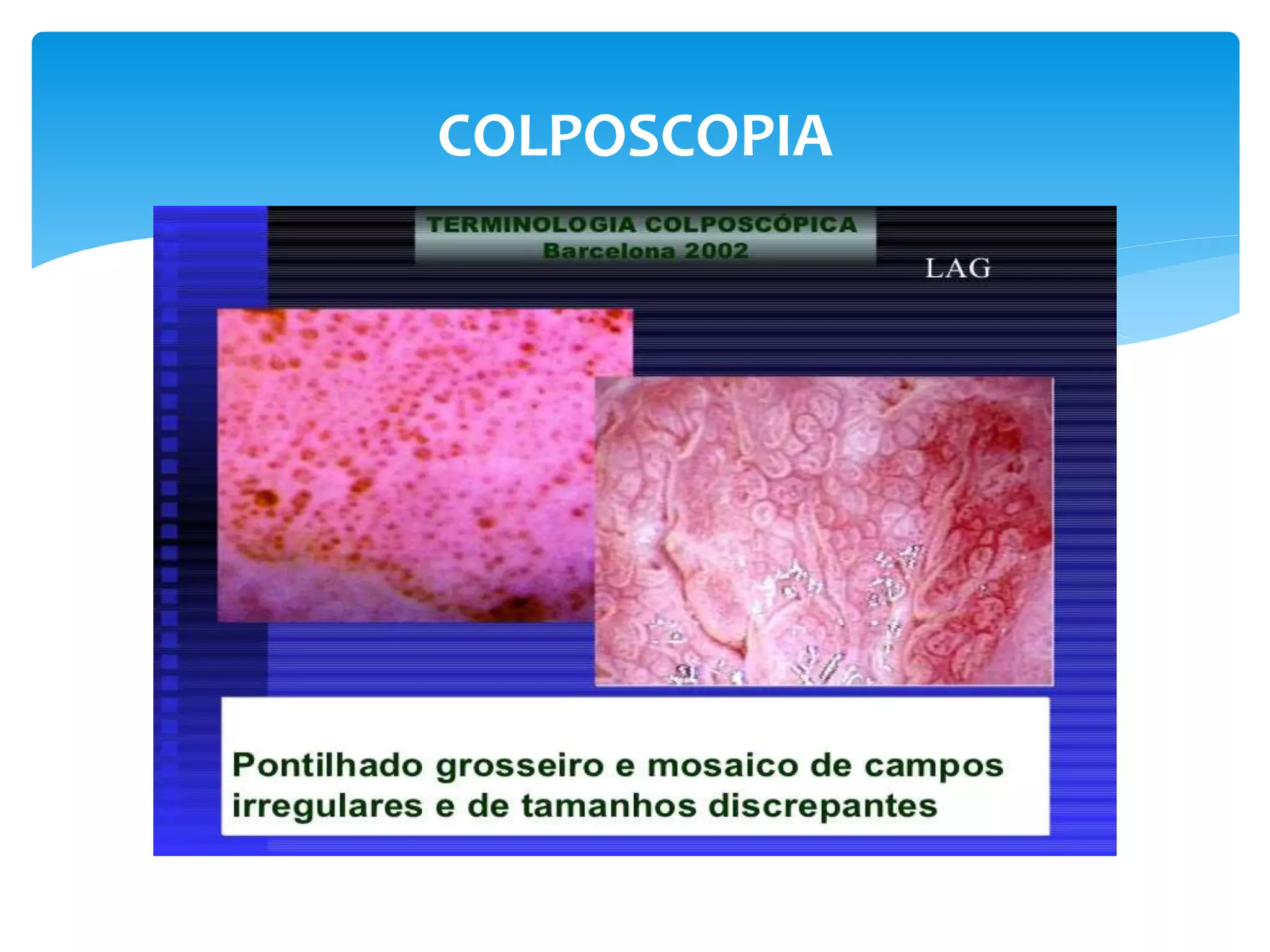 citologia y colposcopia.pptx