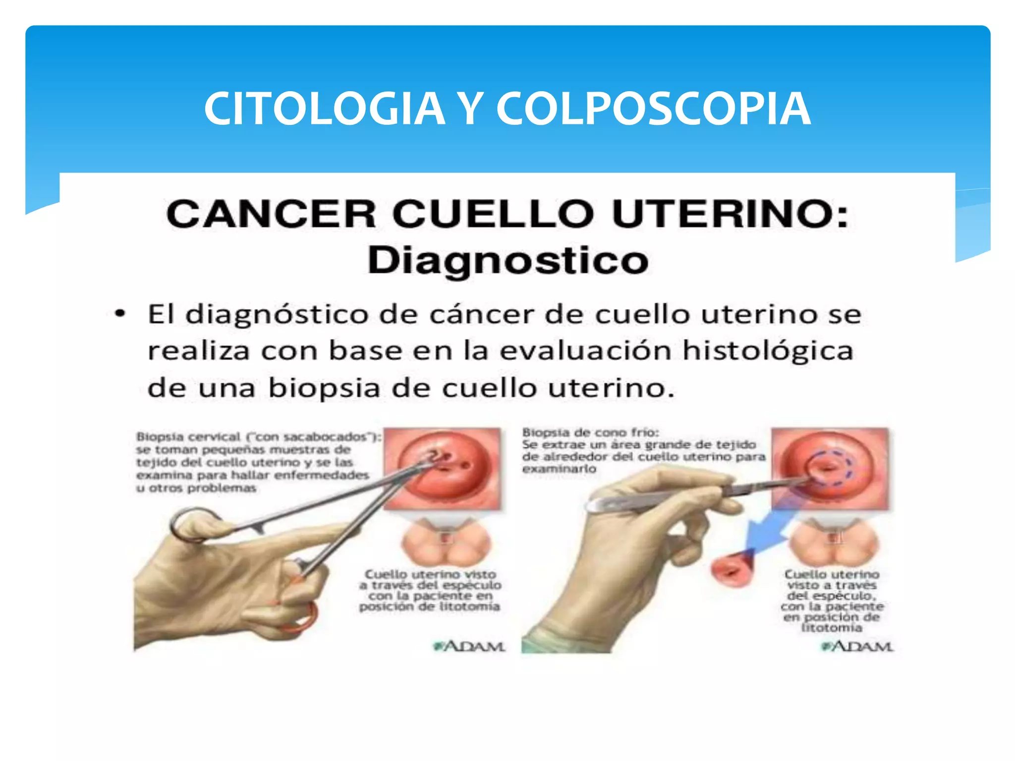 citologia y colposcopia.pptx