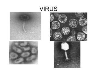 VIRUS 