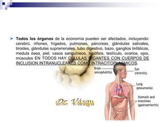 Todos los órganos de la economía pueden ser afectados, incluyendo:
cerebro, riñones, hígados, pulmones, páncreas, glándulas salivales,
tiroides, glándulas suprarrenales, tubo digestivo, bazo, ganglios linfáticos,
medula ósea, piel, vasos sanguíneos, hipófisis, testículo, ovarios, ojos,
músculos EN TODOS HAY CELULAS GIGANTES CON CUERPOS DE
INCLUSION INTRANUCLEARES COMO INTRACITOPLASMICOS.
 