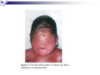 2. Trasplante de órgano
Infección mas común post-transplante.La manifestación es
entre la cuarta y sexta semana.
60-100% de seropositivos excretan HCMV post-trasplante
La mayoría no datos de infección diseminada
Corazón , pulmón , hepáticos, y de médula ósea.
 