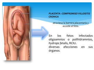PLACENTA : COMPROMISO VILLOSITIS
CRONICA
atraviesa la barrera placentaria y
accede al feto.
En los fetos infectados
oligoamnios o polihidramnios,
hydrops fetalis, RCIU.
diversas afecciones en sus
órganos.
 
