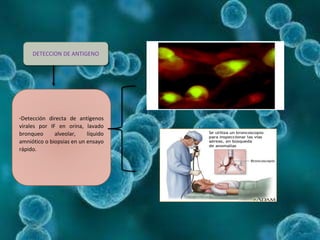 DETECCION DE ANTIGENO
*Detección directa de antígenos
virales por IF en orina, lavado
bronqueo alveolar, líquido
amniótico o biopsias en un ensayo
rápido.
 