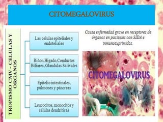 CITOMEGALOVIRUS
 