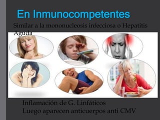 En Inmunocompetentes
Similar a la mononucleosis infecciosa o Hepatitis
Aguda
Inflamación de G. Linfáticos
Luego aparecen anticuerpos anti CMV
 
