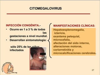 CITOMEGALOVIRUS  INFECCIÓN CONGÉNITA .-  Ocurre en 1 a 3 % de todas  las gestaciones a nivel mundial. Desarrollan sintomatología:  sólo 25% de los niños infectados MANIFESTACIONES CLÍNICAS: Hepatoesplenomegalia,  ictericia,  exantema petequial,  microcefalia,  afectación del oido interno, alteraciones motoras,  coriorretinitis y  microcalcificaciones cerebrales. 