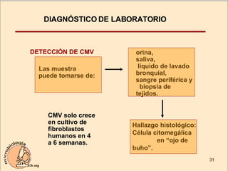 DIAGNÓSTICO DE LABORATORIO DETECCIÓN DE CMV Las muestra  puede tomarse de: orina,  saliva,  líquido de lavado bronquial,  sangre periférica y  biopsia de tejidos. Hallazgo histológico:  Célula citomegálica  en “ojo de buho”.  CMV solo crece en cultivo de fibroblastos humanos en 4  a 6 semanas. 