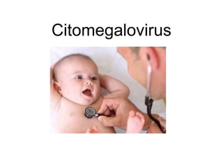 Citomegalovirus
 