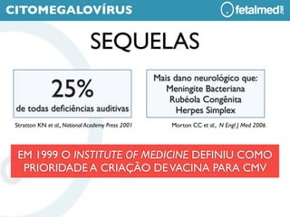 CITOMEGALOVÍRUS

                               SEQUELAS
                                                   Mais dano neurológico que:
               25%                                    Meningite Bacteriana
                                                       Rubéola Congênita
 de todas deﬁciências auditivas                          Herpes Simplex
 Stratton KN et al., National Academy Press 2001       Morton CC et al., N Engl J Med 2006




  EM 1999 O INSTITUTE OF MEDICINE DEFINIU COMO
   PRIORIDADE A CRIAÇÃO DE VACINA PARA CMV
 