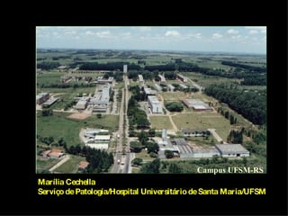Campus UFSM-RS Marília Cechella Serviço de Patologia/Hospital Universitário de Santa Maria/UFSM 