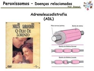 Peroxissomos – Doenças relacionadas
Prof. Emanuel
Adrenoleucodistrofia
(ADL)
 