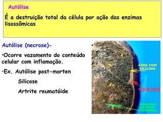 Autólise
 É a destruição total da célula por ação das enzimas
 lisossômicas


Autólise (necrose)-
•Ocorre vazamento do conteúdo
celular com inflamação.
•Ex. Autólise post-morten
      Silicose
      Artrite reumatóide
 