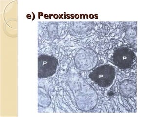 e) Peroxissomos
 