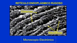 RER
Microscopio Electrónico
 