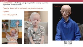 citoskelet
Laminopatije – bolesti koje nastaju kao posledica mutacija na genima
odgovornim za sintezu lamina.
Progerija – bolest koja se manifestuje prevremenim starenjem
Dijabetes
Neke vrste gojaznosti
Sem Berns
1996-2014
 