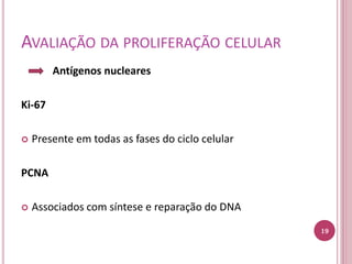 AVALIAÇÃO DA PROLIFERAÇÃO CELULAR
Antígenos nucleares
Ki-67
 Presente em todas as fases do ciclo celular
PCNA
 Associados com síntese e reparação do DNA
19
 