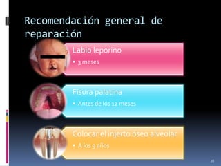 Recomendación general de
reparación
        Labio leporino
        • 3 meses



        Fisura palatina
        • Antes de los 12 meses



        Colocar el injerto óseo alveolar
        • A los 9 años

                                           28
 