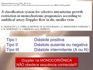 Tipo I Diástole positiva
Tipo II Diástole ausente ou negativa
Tipo III Diástole intermitente (A ou N)
Doppler na MONOCORIÔNICA
NÃO obedece sequência conhecida!!!
Doppler na MONOCORIÔNICA
NÃO obedece sequência conhecida!!!
 