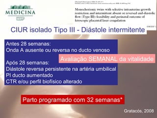 Antes 28 semanas:
Onda A ausente ou reversa no ducto venoso
Após 28 semanas:
Diástole reversa persistente na artéria umbilical
PI ducto aumentado
CTR e/ou perfil biofísico alterado
Gratacós, 2008
Avaliação SEMANAL da vitalidade
Parto programado com 32 semanas*Parto programado com 32 semanas*
CIUR isolado Tipo III - Diástole intermitente
 