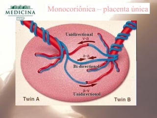 Monocoriônica – placenta única
 