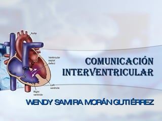 COMUNICACIÓN INTERVENTRICULAR WENDY SAMIRA MORÁN GUTIÉRREZ 