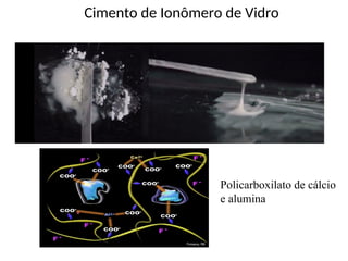 Cimento de Ionômero de Vidro
Policarboxilato de cálcio
e alumina
 
