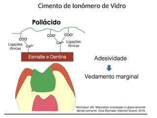 Cimento de Ionômero de Vidro
 