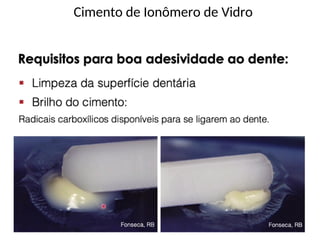Cimento de Ionômero de Vidro
 