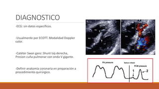 DIAGNOSTICO
-ECG: sin datos específicos.
-Usualmente por ECOTT. Modalidad Doppler
color.
-Catéter Swan ganz: Shunt Izq-derecha,
Presion cuña pulmonar con onda V gigante.
-Definir anatomía coronaria en preparación a
procedimiento quirúrgico.
 