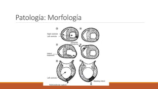 Patología: Morfología
 