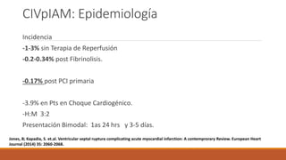CIVpIAM: Epidemiología
Incidencia
-1-3% sin Terapia de Reperfusión
-0.2-0.34% post Fibrinolisis.
-0.17% post PCI primaria
-3.9% en Pts en Choque Cardiogénico.
-H:M 3:2
Presentación Bimodal: 1as 24 hrs y 3-5 días.
Jones, B; Kapadia, S. et.al. Ventricular septal ruptura complicating acute myocardial infarction: A contemprorary Review. European Heart
Journal (2014) 35: 2060-2068.
 
