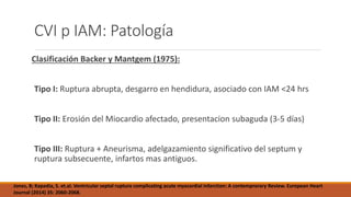 CVI p IAM: Patología
Clasificación Backer y Mantgem (1975):
Tipo I: Ruptura abrupta, desgarro en hendidura, asociado con IAM <24 hrs
Tipo II: Erosión del Miocardio afectado, presentacion subaguda (3-5 días)
Tipo III: Ruptura + Aneurisma, adelgazamiento significativo del septum y
ruptura subsecuente, infartos mas antiguos.
Jones, B; Kapadia, S. et.al. Ventricular septal ruptura complicating acute myocardial infarction: A contemprorary Review. European Heart
Journal (2014) 35: 2060-2068.
 