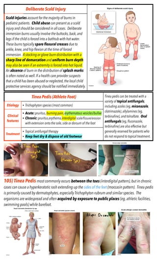 Moccasin Distribution Rash CK-DERMATOLOGY-2022 CK-DERMATOLOGY-2022.pdf