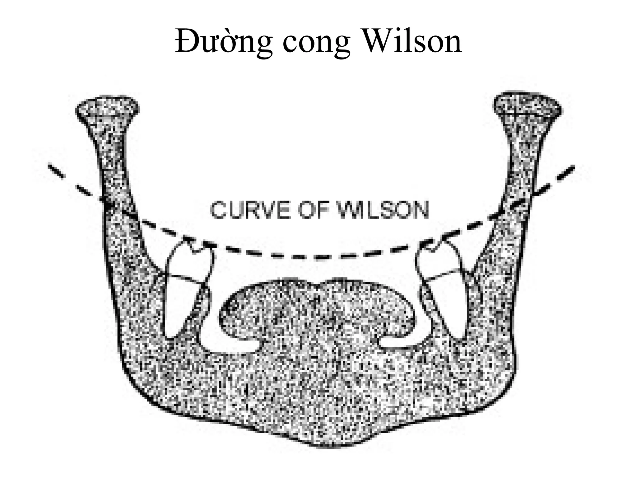 Đường cong Wilson
 