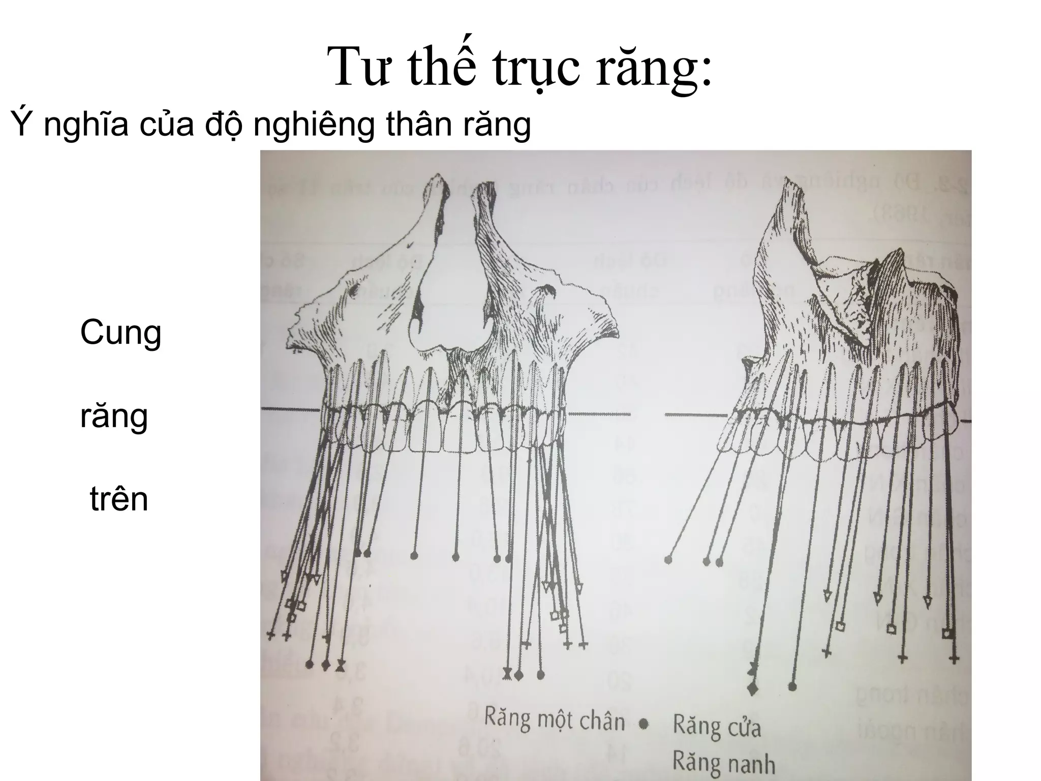 Tư thế trục răng:
Ý nghĩa của độ nghiêng thân răng




    Cung

    răng

    trên
 