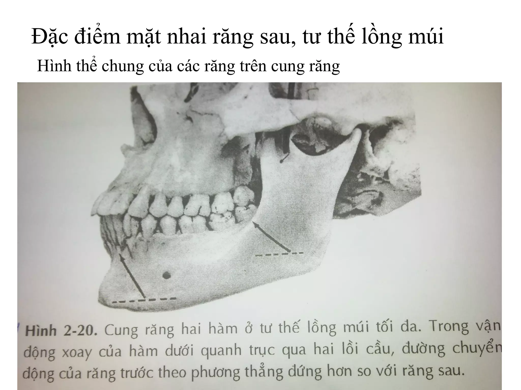 Đặc điểm mặt nhai răng sau, tư thế lồng múi
Hình thể chung của các răng trên cung răng
 