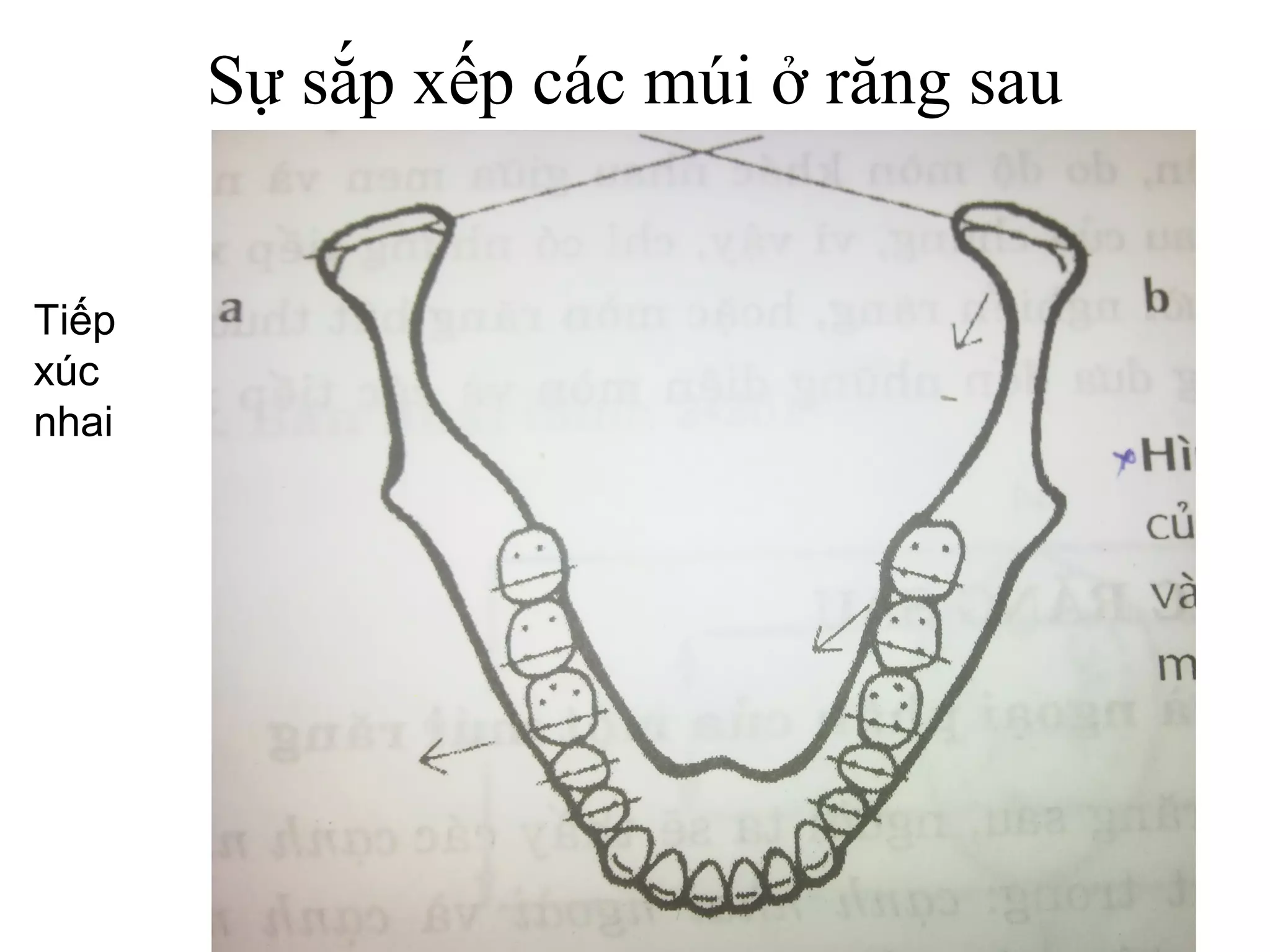 Sự sắp xếp các múi ở răng sau


Tiếp
xúc
nhai
 
